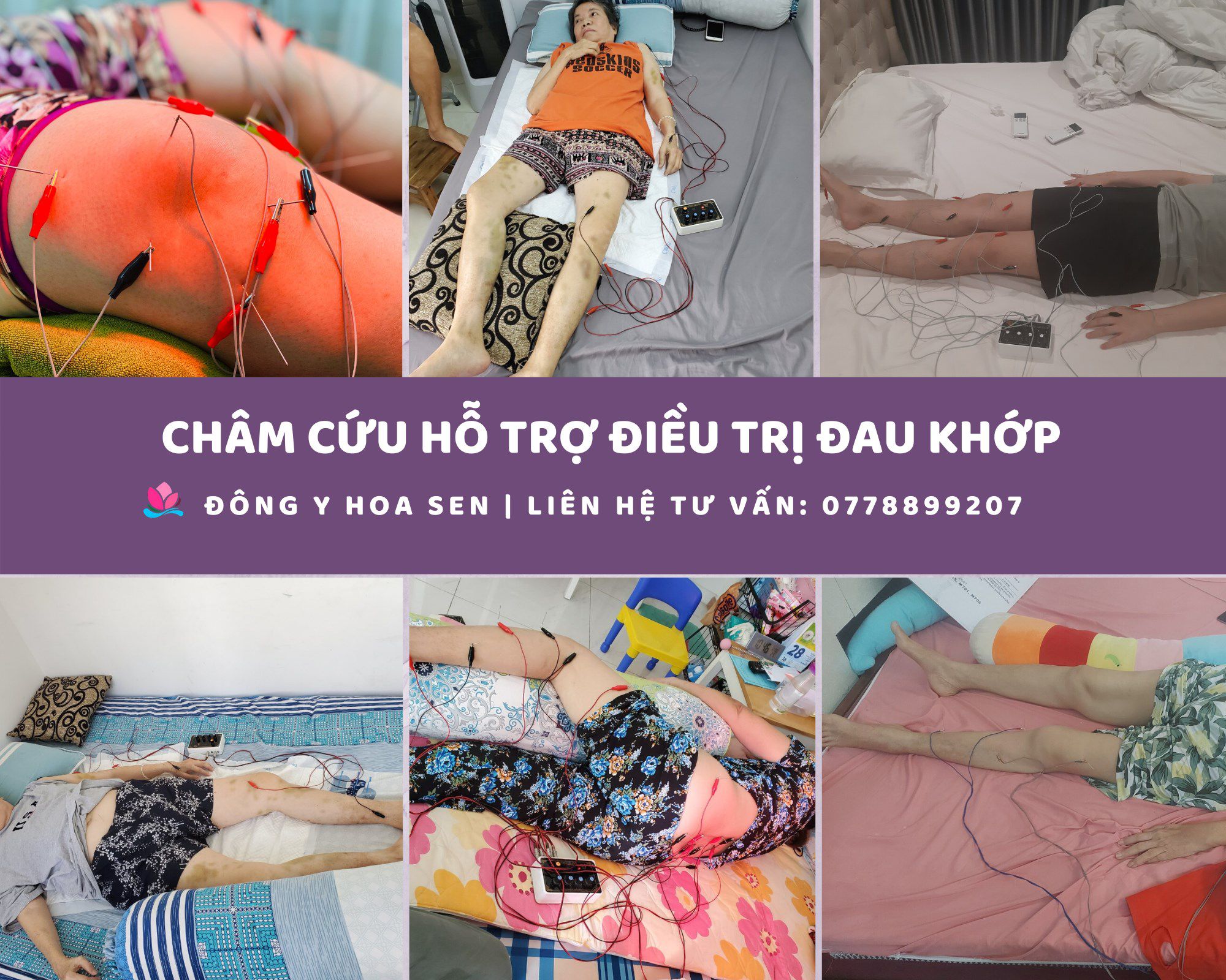 Odoo • Hình ảnh với chú thích