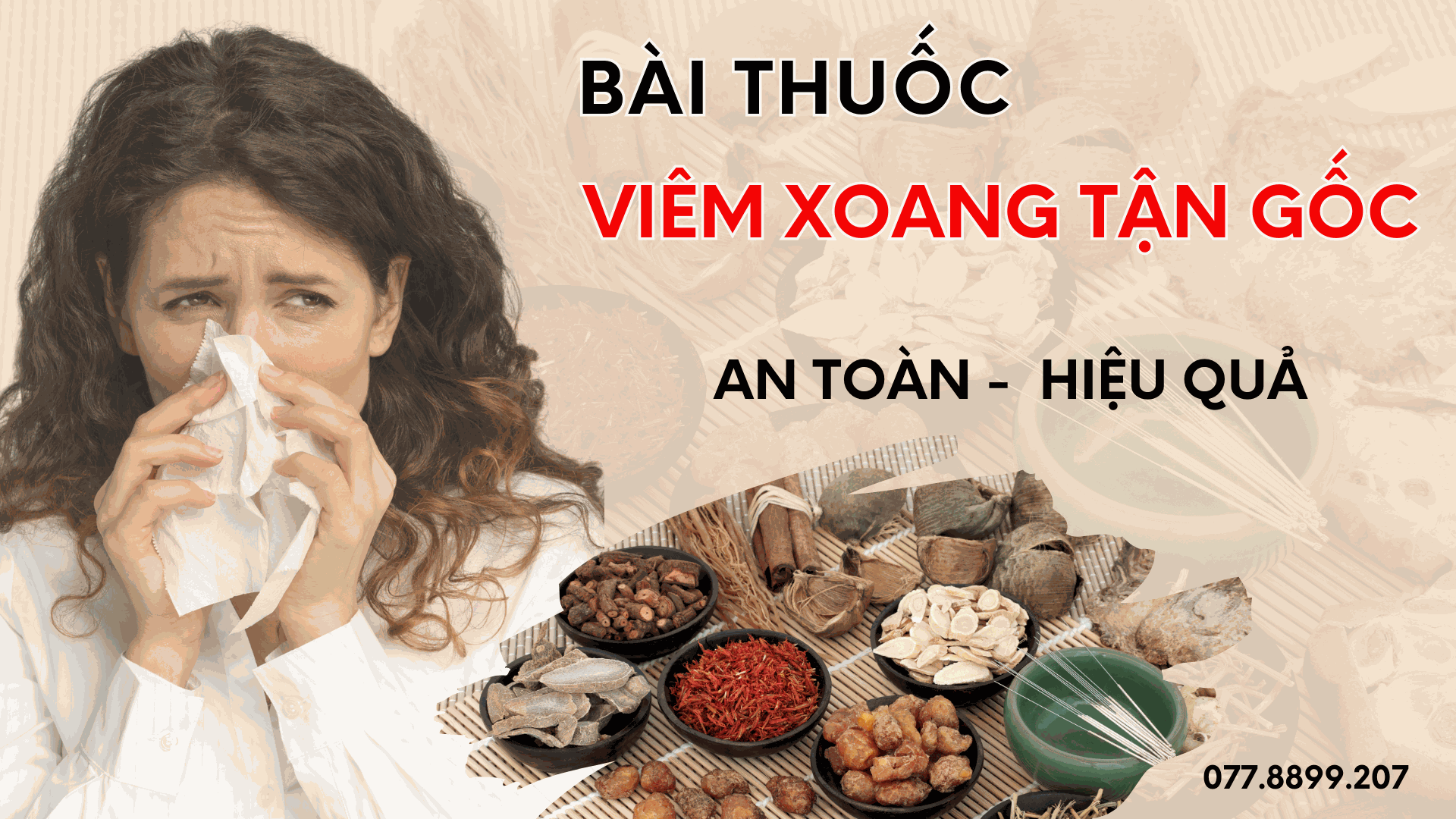 Odoo • Hình ảnh với chú thích