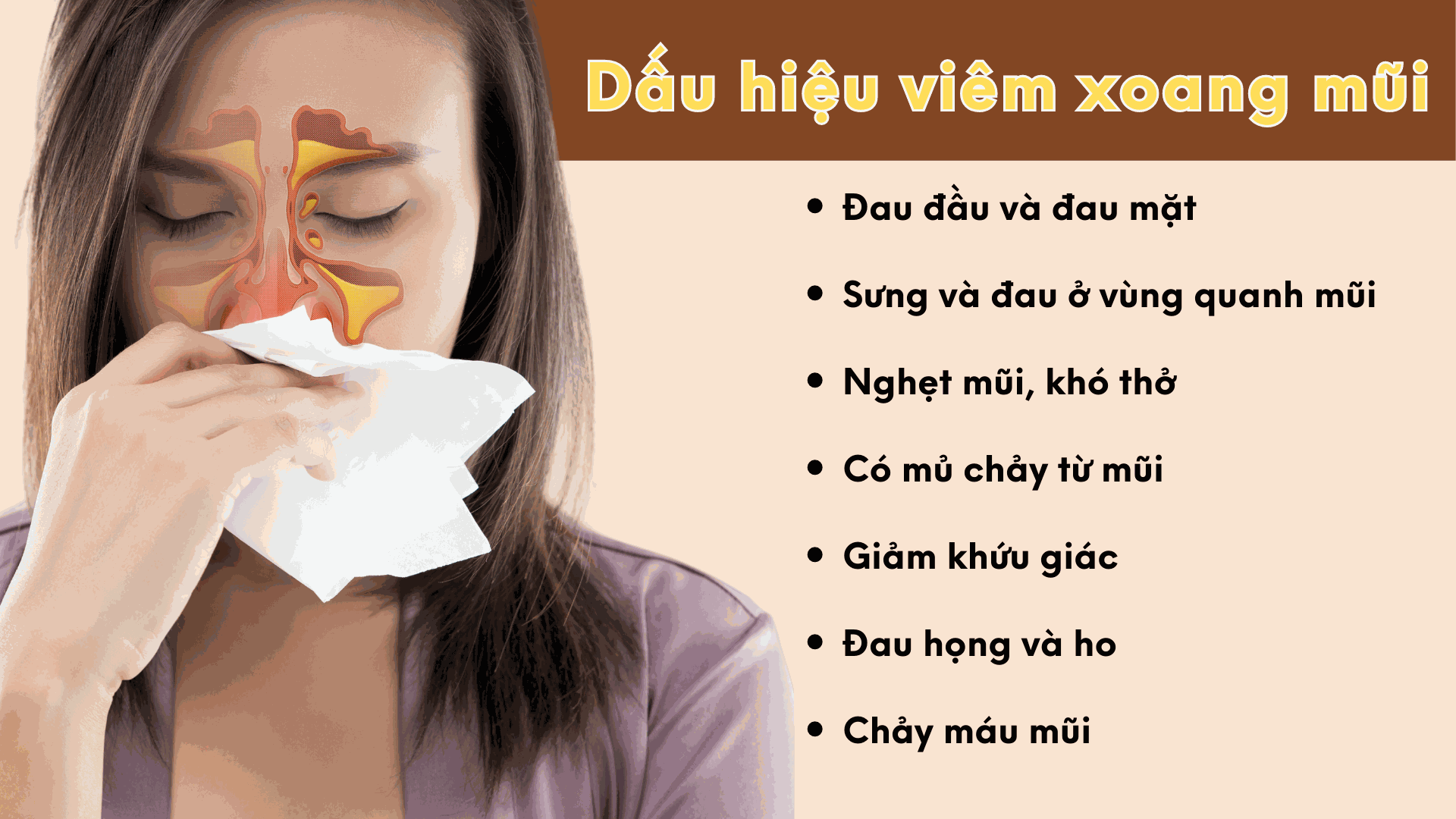 Odoo • Hình ảnh với chú thích